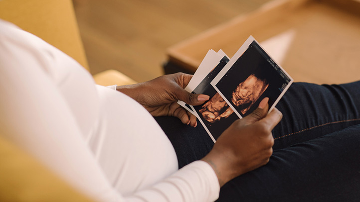 3d and 4d ultrasound pregnancy, woman looking at 3D ultrasound photos