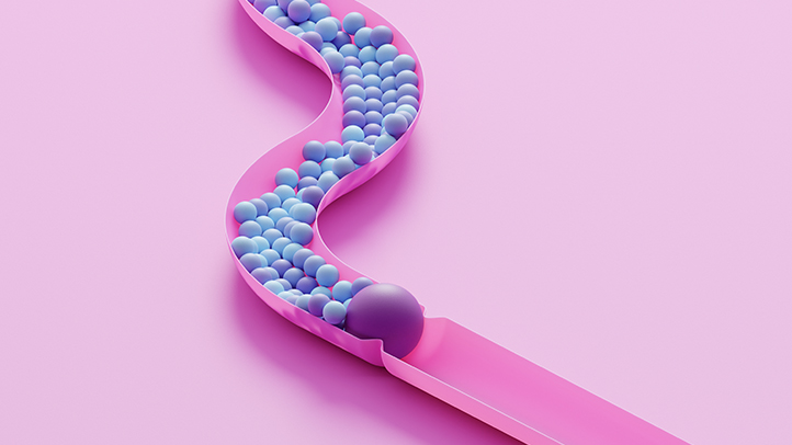 blocked fallopian tubes, colorful balls blocked on pink track